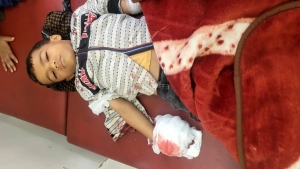 اليمن: إصابة طفل بعملية قنص لمسلحين حوثيين في وادي صالة بتعز