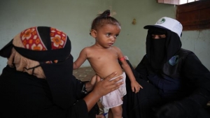 اليمن: 668 طفل يعانون من سوء التغذية في تبن بلحج