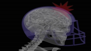صحة: 8 ‫أعراض تكشف الإصابة بارتجاج المخ
