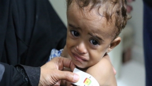 اليمن: مساهمة أمريكية بقيمة 10 ملايين دولار لإنقاذ حياة 144 ألف طفل من سوء التغذية الحاد