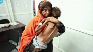 روما: 20% من سكان اليمن سيعانون من مستوى خطير في انعدام الأمن الغذائي خلال الأشهر المقبلة