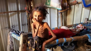 واشنطن: شبكة دولية تتوقع انزلاق مليون شخص إضافي في اليمن إلى هوة المجاعة بحلول يونيو 2024