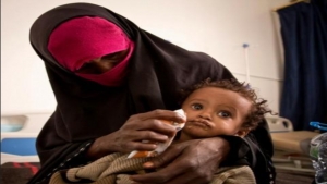 اليمن: إيقاف برنامج الوقاية من سوء التغذية يترك 3 ملايين طفل وامرأة عرضة للأمراض والوفاة