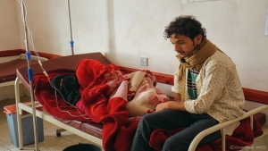 اليمن: تسجيل 508 حالات إصابة جديدة بالكوليرا في أول شهرين من العام الجاري