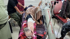 اليمن: قتيل وجريح بعملية قنص للحوثيين بمدينة تعز
