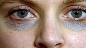 صحة: الهالات السوداء حول العين.. كيف تنشأ؟ وما علاجها؟