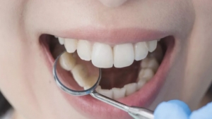 صحة: نصائح مهمة لتحسين صحة الأسنان