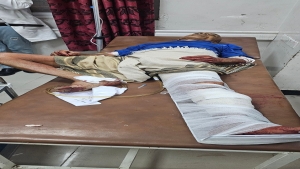 اليمن: إصابة مدني برصاص قناص حوثي في مدينة تعز