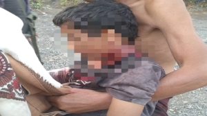 اليمن: وفاة طفل متأثراً بجراحه جراء قنص في القبيطة