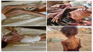 اليمن: المجاعة تزحف بصمت وتحصد أرواح الضعفاء في عبس