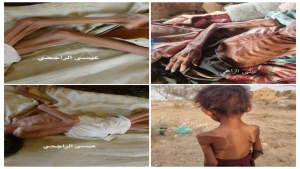 اليمن: أكثر من 41 ألف شخص يواجهون خطر المجاعة في مديرية عبس بحجة
