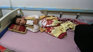 اليمن: 8 وفيات و1.2 ألف إصابة بالحصبة في مناطق نفوذ الحكومة الشهر الماضي