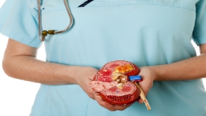 صحة: أطعمة ضارة بالكلى