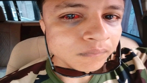 اليمن: شاب يتهم ضابطا بالاعتداء عليه داخل قسم شرطة البريقة 