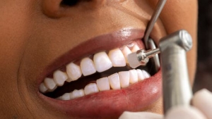 صحة: أطعمة ومشروبات تضعف مينا الأسنان دون أن ننتبه