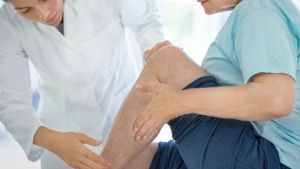 صحة: دوالي الساقين.. النساء أكثر إصابة وهذه علامات الخطر